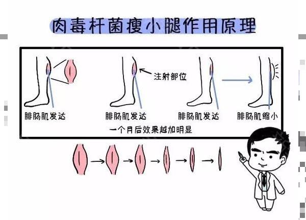 就想问一下现在注射瘦脸注射瘦腿的费用是多少?