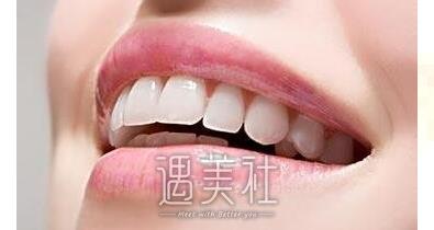 上海种植牙价格一般一颗怎么收费？是不是很贵啊？