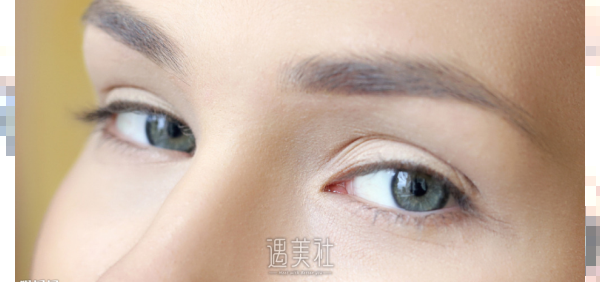 北京生物焊接双眼皮大概什么价格?收费贵吗?