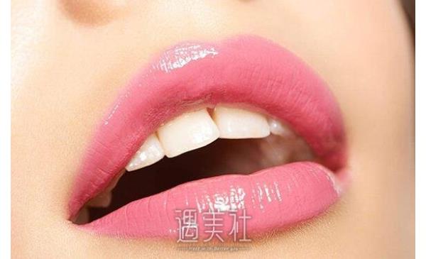 北京大学深圳医院牙齿矫正贵吗?影响因素有哪些?