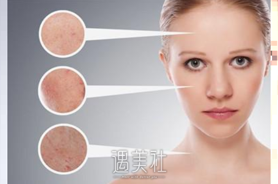 上海皮肤病医院做激光费用大概多少？