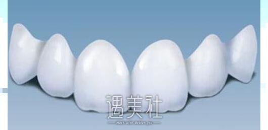 上海种植牙价格表2020版全新发布~