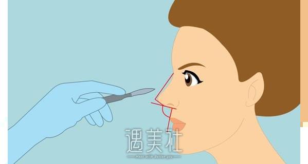 深圳广和鼻部手术费用大概多少？