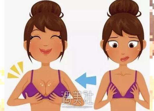 上海自体脂肪隆胸费用多少?贵吗?