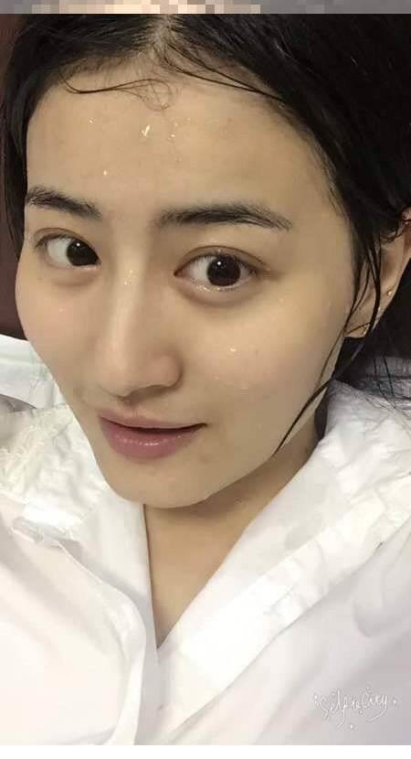 北京协和医院著名整形美容美瞳线案例反馈评价,极具价值的美丽奇迹产生在王智医生的技术操纵中，收费标准介绍