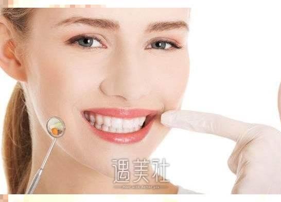 上海纯钛烤瓷牙价格：美观性强、时间短、保障充足的牙齿维护