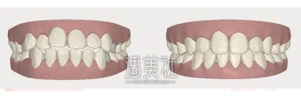 诊疗价目表曝光：上海浦东曙光医院牙齿整形服务助你重塑完美整齐脸庞